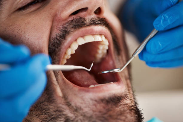 Best Emergency Cosmetic Dentistry (e.g., broken veneers) in Menonee, MI